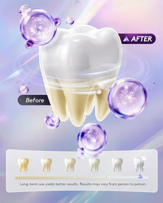 Hismile v34 Colour Corrector, Tooth Stain Concealer, Teeth Whitening Booster, Purple Toothpaste, Color Correcting Technology, V34, Tooth Colour Corrector